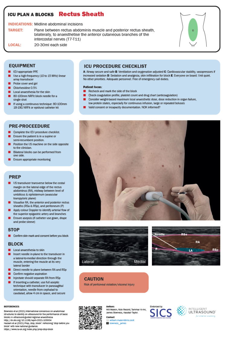 Rectus Sheath Block Target Focused Ultrasound In Intensive Care | SICS